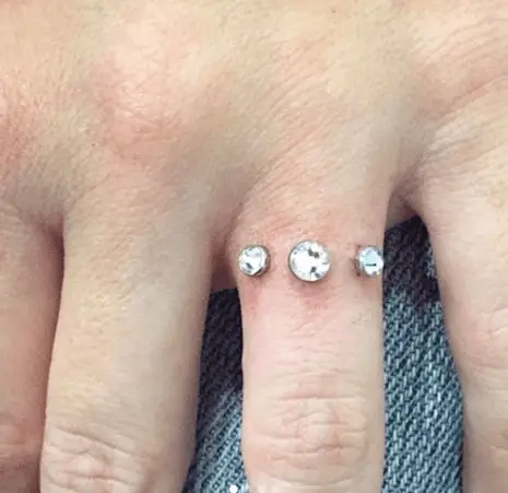 Diamond Implant on Finger